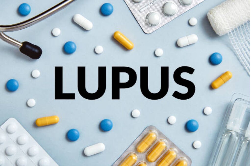 The word Lupus is surrounded by blue, orange and white pills, pill packages, a stethoscope and a bandage wrap.