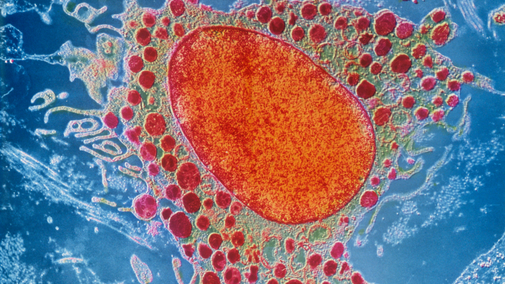 Expert NC Disability Lawyers for Rheumatoid Arthritis Claims