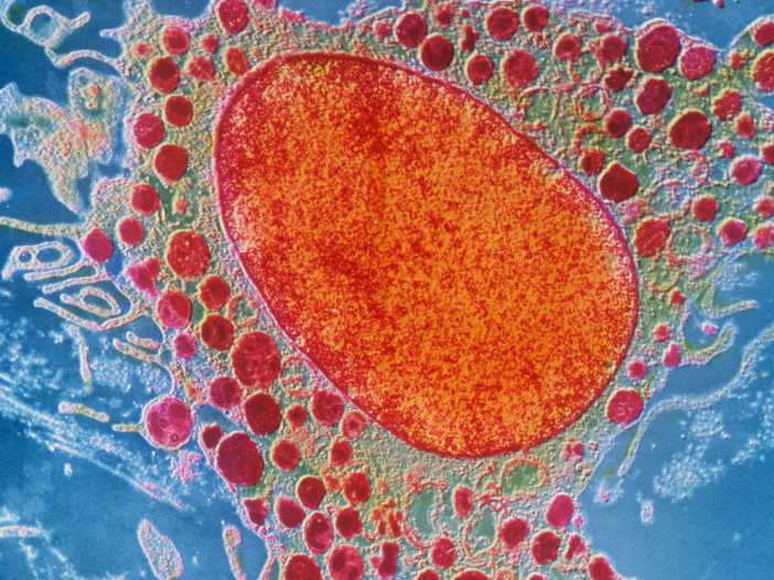 Inflammation in the body can trigger painful inflammation in the form of rheumatoid arthritis. Picture shown is a call with inflammation.