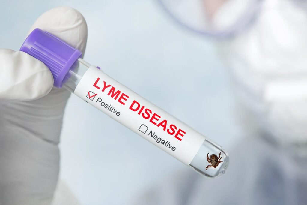 Lab tech wearing white gloves holds a vial containing a tick. The label reads Lyme Disease and shows a checkmark for a positive result.