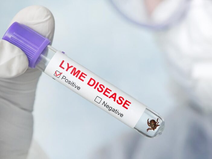 Lab tech wearing white gloves holds a vial containing a tick. The label reads Lyme Disease and shows a checkmark for a positive result.