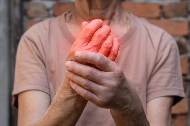 Older white person holds wrist of throbbing hand with red superimposed over the painful area to indicate severe inflammation of arthritis.