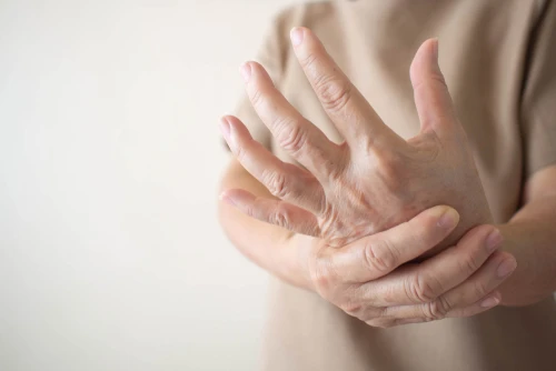 Is Lupus a Disability? Get Approved for Benefits