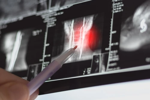 What Not to Say in a Disability Interview?